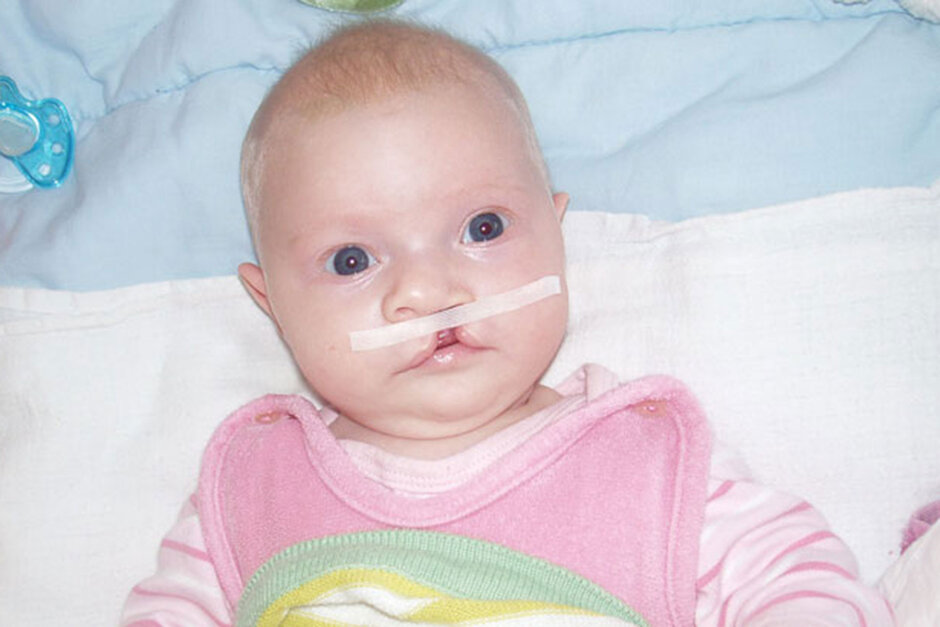 Ein Kind nach erfolgreicher Operation