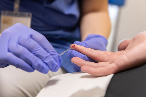 Kapillarblut wird aus dem Finger entnommen