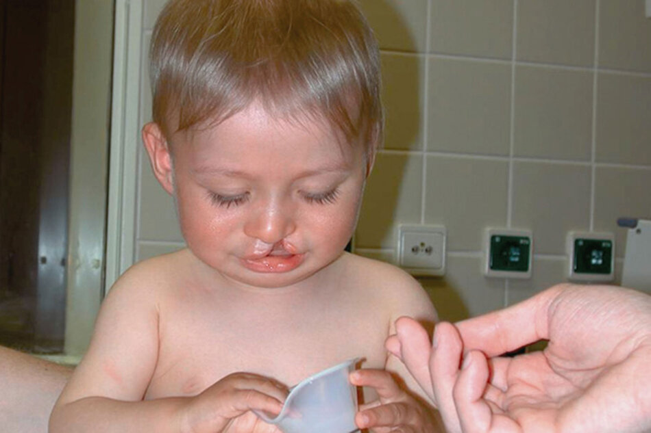 Das Siegener Behandlungskonzept ist besonders sicher